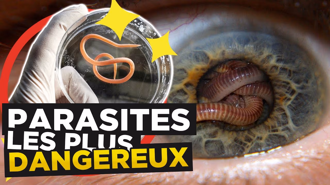 Les PARASITES les plus DANGEREUX AU MONDE