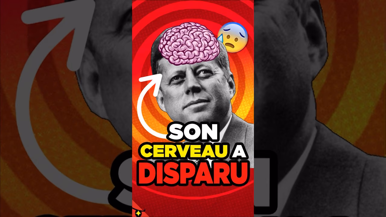 Le cerveau de JFK a DISPARU !
